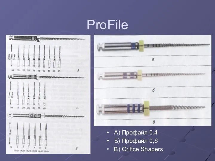 ProFile А) Профайл 0,4 Б) Профайл 0,6 В) Orifice Shapers