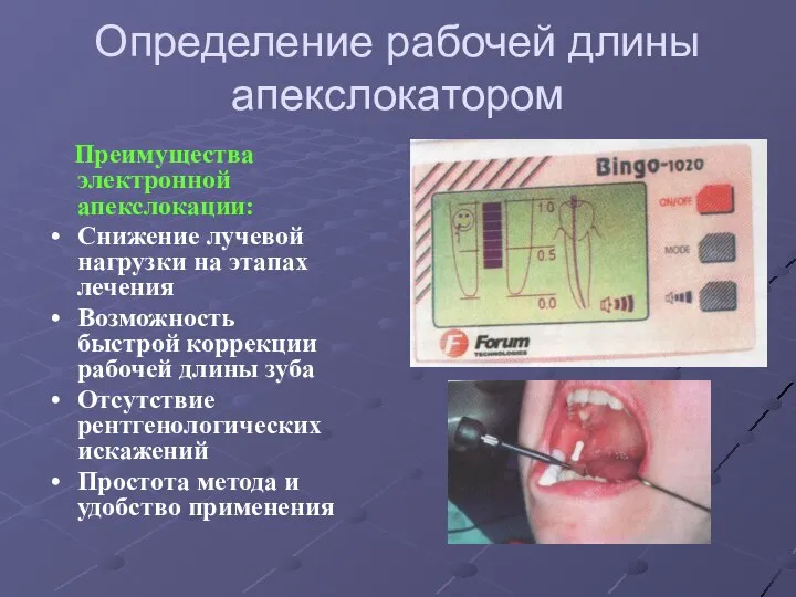 Определение рабочей длины апекслокатором Преимущества электронной апекслокации: Снижение лучевой нагрузки на этапах