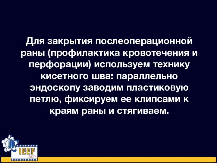 Для закрытия послеоперационной раны (профилактика кровотечения и перфорации) используем технику кисетного шва: