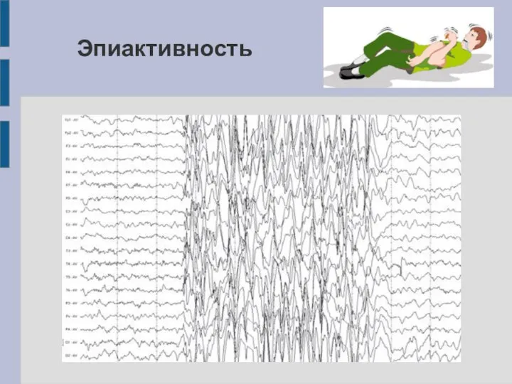 Эпиактивность