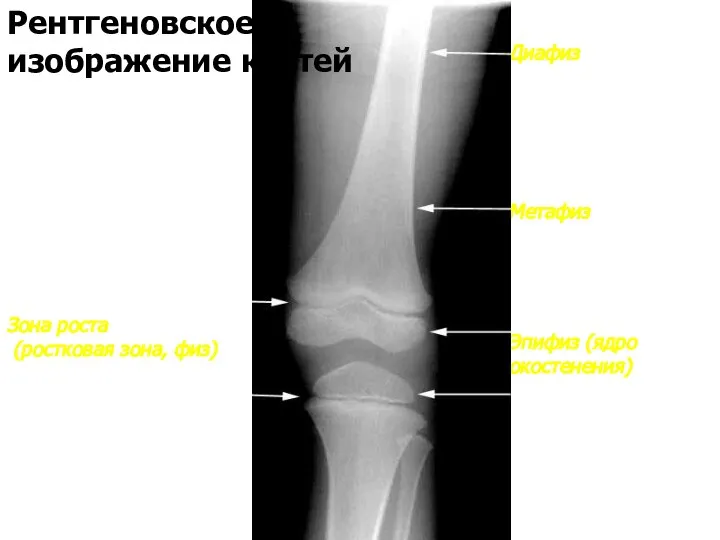Диафиз Метафиз Эпифиз (ядро окостенения) Зона роста (ростковая зона, физ) Рентгеновское изображение костей