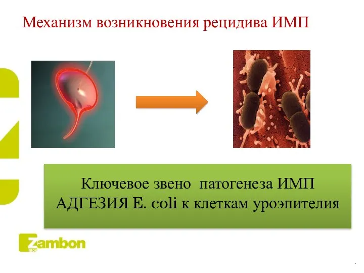 Механизм возникновения рецидива ИМП