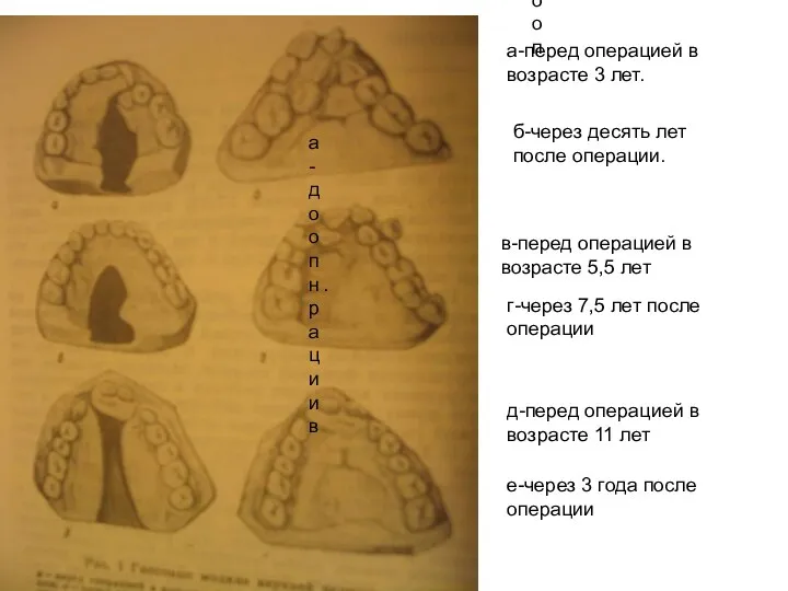 До оп До оп . а-до опнрации в а-перед операцией в возрасте