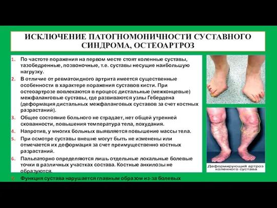 ИСКЛЮЧЕНИЕ ПАТОГНОМОНИЧНОСТИ СУСТАВНОГО СИНДРОМА, ОСТЕОАРТРОЗ По частоте поражения на первом месте стоят