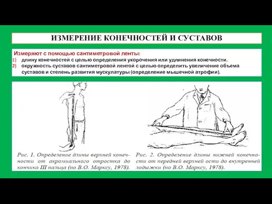 ИЗМЕРЕНИЕ КОНЕЧНОСТЕЙ И СУСТАВОВ Измеряют с помощью сантиметровой ленты: длину конечностей с