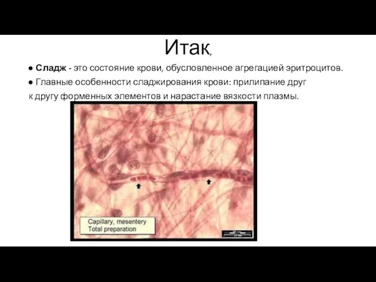 Итак, Сладж - это состояние крови, обусловленное агрегацией эритроцитов. Главные особенности сладжирования