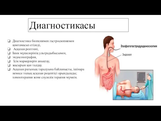 Диагностикасы Диагностика биопсиямен гастроскопиямен қамтамасыз етіледі, Асқазан рентгені, Ішек мүшелерінің ультрадыбысымен, эндосонография,