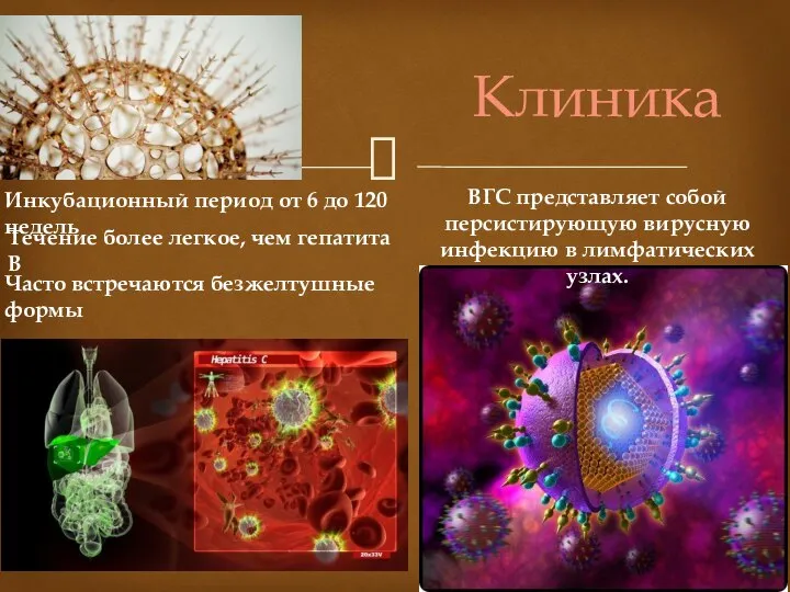 Клиника Инкубационный период от 6 до 120 недель Течение более легкое, чем