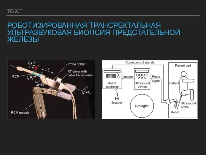 ТЕКСТ РОБОТИЗИРОВАННАЯ ТРАНСРЕКТАЛЬНАЯ УЛЬТРАЗВУКОВАЯ БИОПСИЯ ПРЕДСТАТЕЛЬНОЙ ЖЕЛЕЗЫ