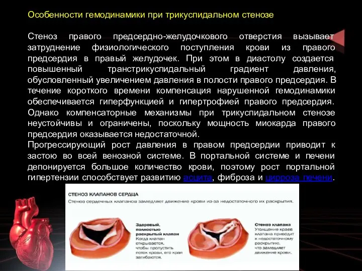 Особенности гемодинамики при трикуспидальном стенозе Стеноз правого предсердно-желудочкового отверстия вызывает затруднение физиологического