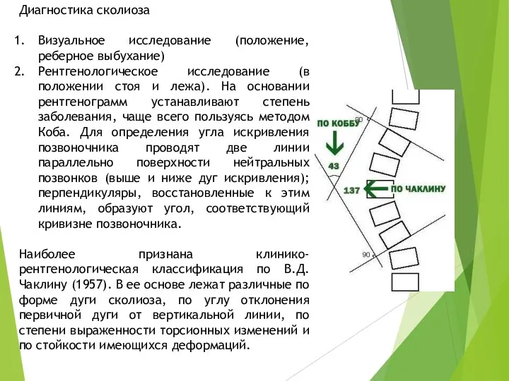 Диагностика сколиоза Визуальное исследование (положение, реберное выбухание) Рентгенологическое исследование (в положении стоя