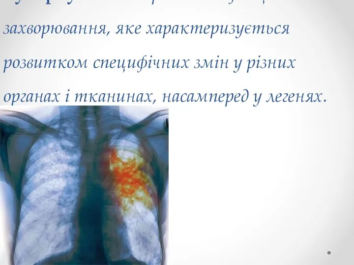 Туберкульоз — хронічне інфекційне захворювання, яке характеризується розвитком специфічних змін у різних
