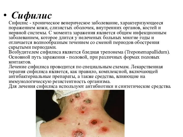 Сифилис Сифилис - хроническое венерическое заболевание, характеризующееся поражением кожи, слизистых оболочек, внутренних