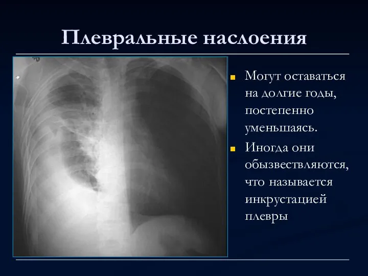 Плевральные наслоения Могут оставаться на долгие годы, постепенно уменьшаясь. Иногда они обызвествляются, что называется инкрустацией плевры