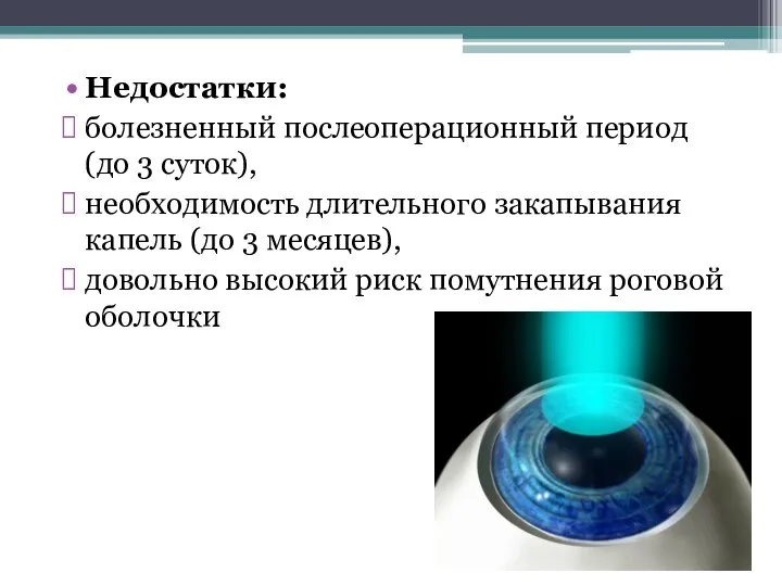 Недостатки: болезненный послеоперационный период (до 3 суток), необходимость длительного закапывания капель (до