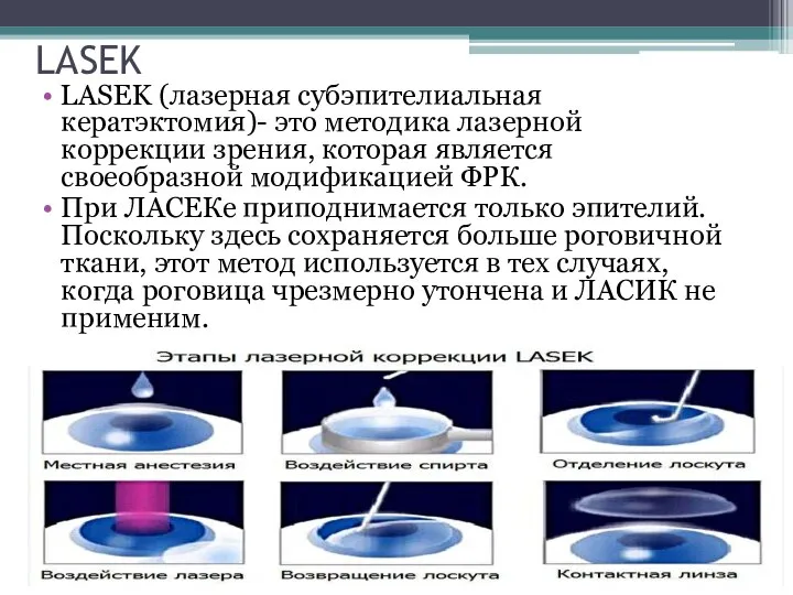 LASEK LASEK (лазерная субэпителиальная кератэктомия)- это методика лазерной коррекции зрения, которая является