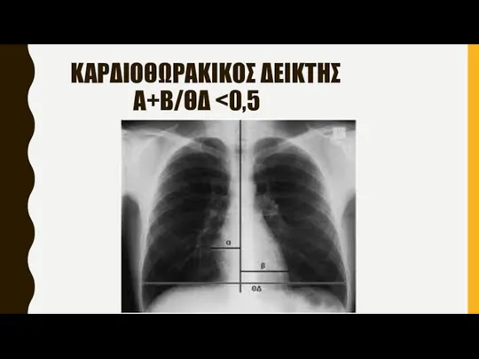 ΚΑΡΔΙΟΘΩΡΑΚΙΚΟΣ ΔΕΙΚΤΗΣ A+B/ΘΔ