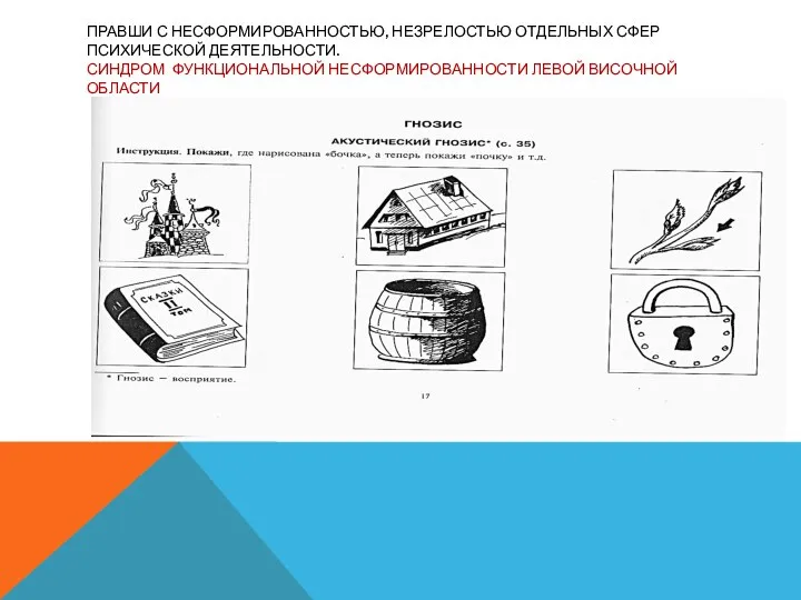 ПРАВШИ С НЕСФОРМИРОВАННОСТЬЮ, НЕЗРЕЛОСТЬЮ ОТДЕЛЬНЫХ СФЕР ПСИХИЧЕСКОЙ ДЕЯТЕЛЬНОСТИ. СИНДРОМ ФУНКЦИОНАЛЬНОЙ НЕСФОРМИРОВАННОСТИ ЛЕВОЙ ВИСОЧНОЙ ОБЛАСТИ