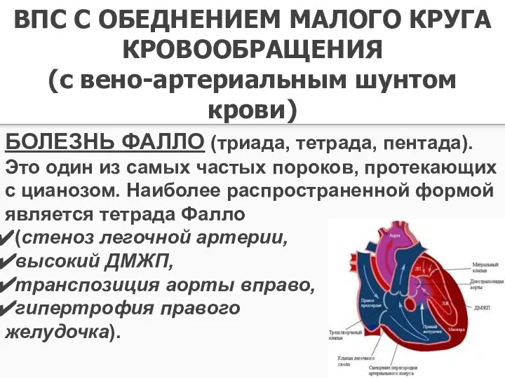 ВПС С ОБЕДНЕНИЕМ МАЛОГО КРУГА КРОВООБРАЩЕНИЯ (с вено-артериальным шунтом крови) БОЛЕЗНЬ ФАЛЛО