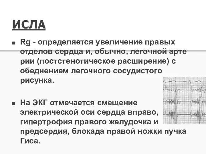 ИСЛА Rg - определяется увеличение правых отделов сердца и, обычно, легочной арте­рии