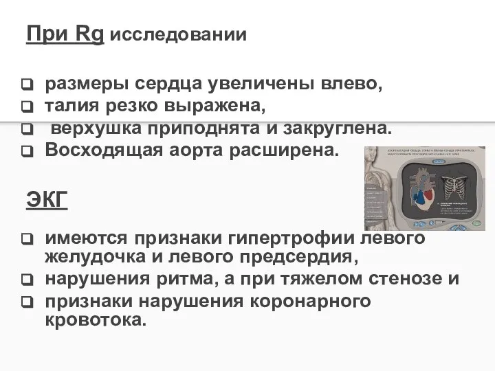 При Rg исследовании размеры сердца увеличены влево, талия резко выраже­на, верхушка приподнята