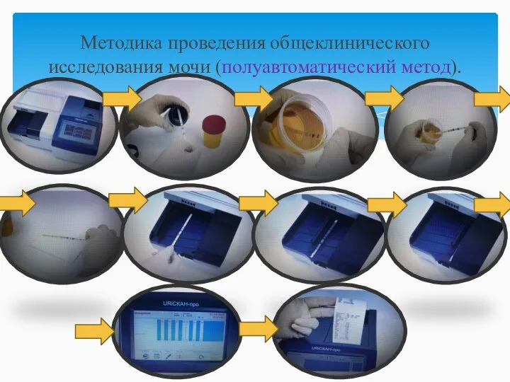 Методика проведения общеклинического исследования мочи (полуавтоматический метод).