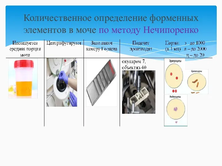 Количественное определение форменных элементов в моче по методу Нечипоренко