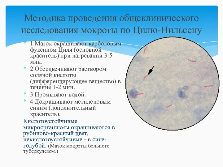 Методика проведения общеклинического исследования мокроты по Цилю-Нильсену 1.Мазок окрашивают карболовым фуксином Циля