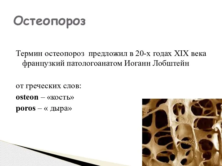 Термин остеопороз предложил в 20-х годах XIX века французкий патологоанатом Иоганн Лобштейн