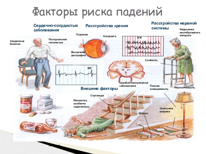 Факторы риска падений Сердечно-сосудистые заболевания Расстройства зрения Расстройства нервной системы Глаукома Мышечная