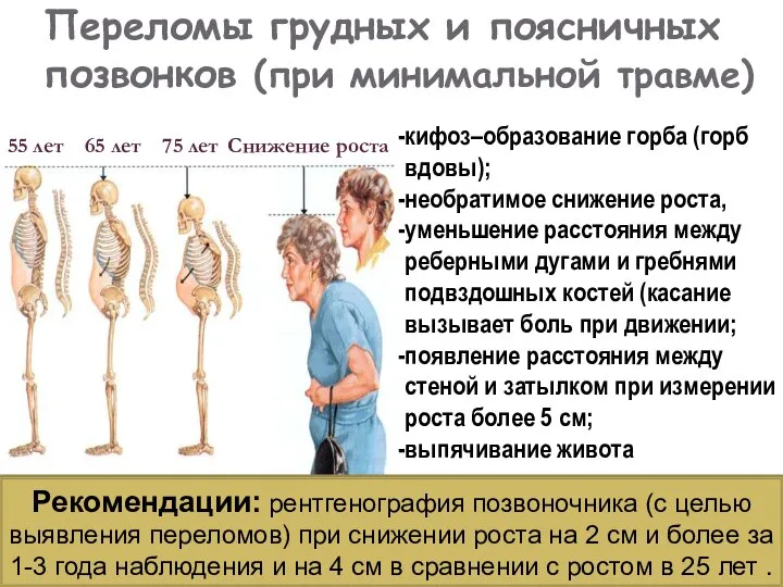 Переломы грудных и поясничных позвонков (при минимальной травме) Рекомендации: рентгенография позвоночника (с