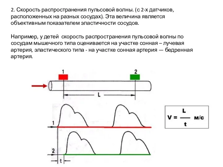 2. Скорость распространения пульсовой волны. (с 2-х датчиков, расположенных на разных сосудах).