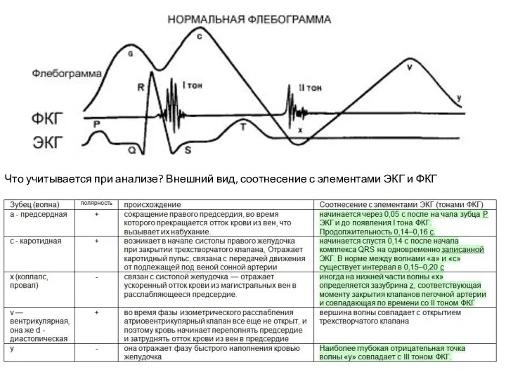 Что учитывается при анализе? Внешний вид, соотнесение с элементами ЭКГ и ФКГ