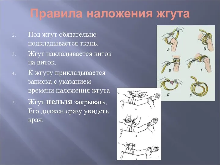 Правила наложения жгута Под жгут обязательно подкладывается ткань. Жгут накладывается виток на