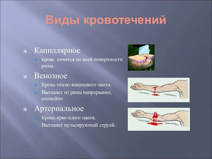 Виды кровотечений Капиллярное кровь сочится по всей поверхности раны. Венозное Кровь темно-вишневого