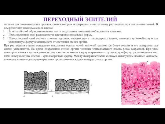 типичен для мочеотводящих органов, стенки которых подвержены значительному растяжению при заполнении мочой.