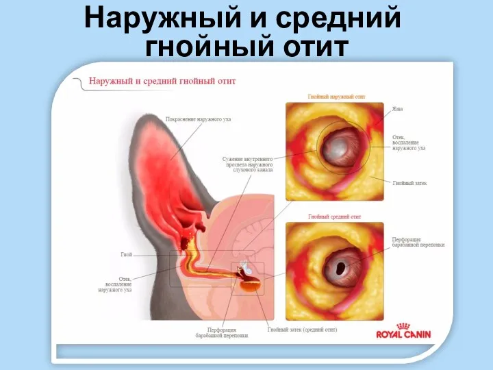 Наружный и средний гнойный отит