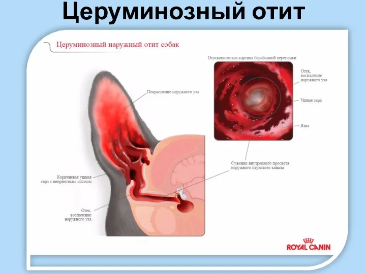 Церуминозный отит