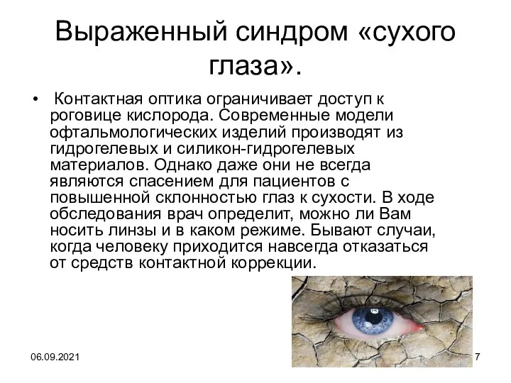 06.09.2021 Выраженный синдром «сухого глаза». Контактная оптика ограничивает доступ к роговице кислорода.