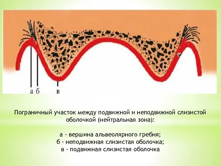 Пограничный участок между подвижной и неподвижной слизистой оболочкой (нейтральная зона): а -