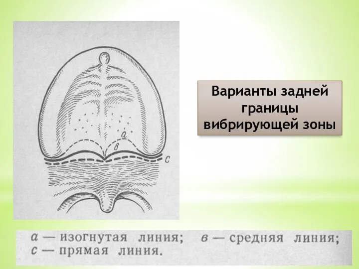 Варианты задней границы вибрирующей зоны