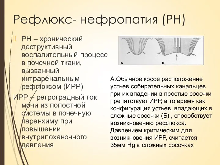 Рефлюкс- нефропатия (РН) РН – хронический деструктивный воспалительный процесс в почечной ткани,