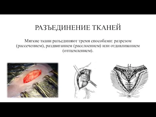 РАЗЪЕДИНЕНИЕ ТКАНЕЙ Мягкие ткани разъединяют тремя способами: разрезом (рассечением), раздвиганием (расслоением) или отдавливанием (отщемлением).