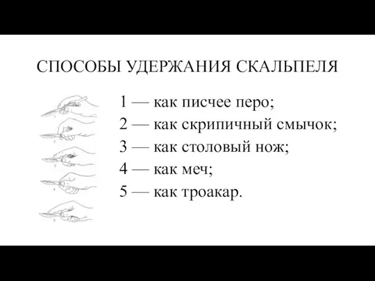 СПОСОБЫ УДЕРЖАНИЯ СКАЛЬПЕЛЯ 1 — как писчее перо; 2 — как скрипичный