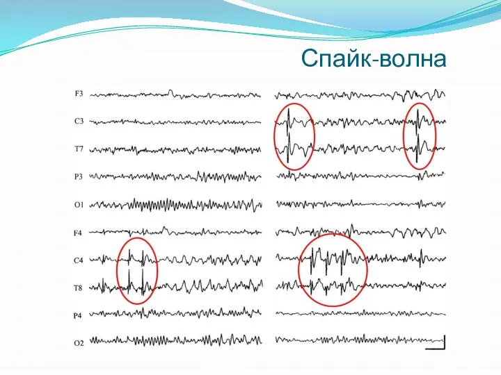 Спайк-волна