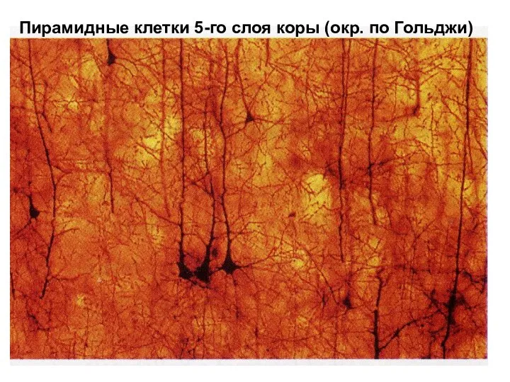 Пирамидные клетки 5-го слоя коры (окр. по Гольджи)