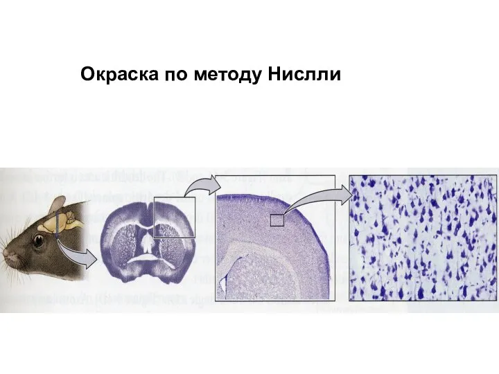 Окраска по методу Нислли