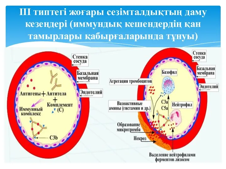 III типтегі жоғары сезімталдықтың даму кезеңдері (иммундық кешендердің қан тамырлары қабырғаларында тұнуы)