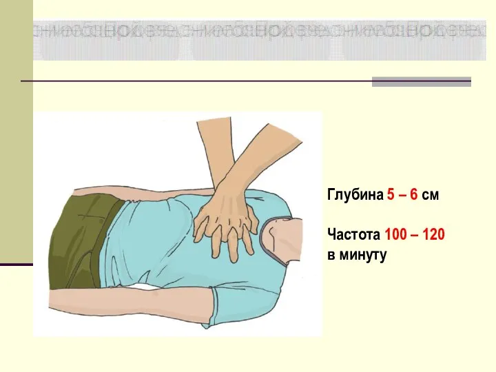 Глубина 5 – 6 см Частота 100 – 120 в минуту