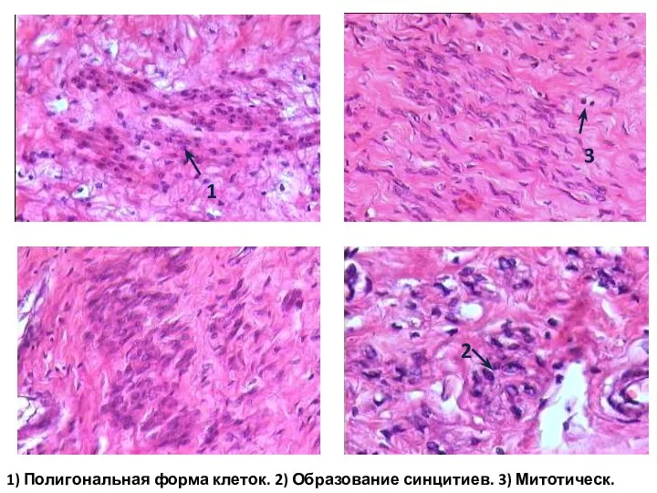 1 2 3 1) Полигональная форма клеток. 2) Образование синцитиев. 3) Митотическ. активность.